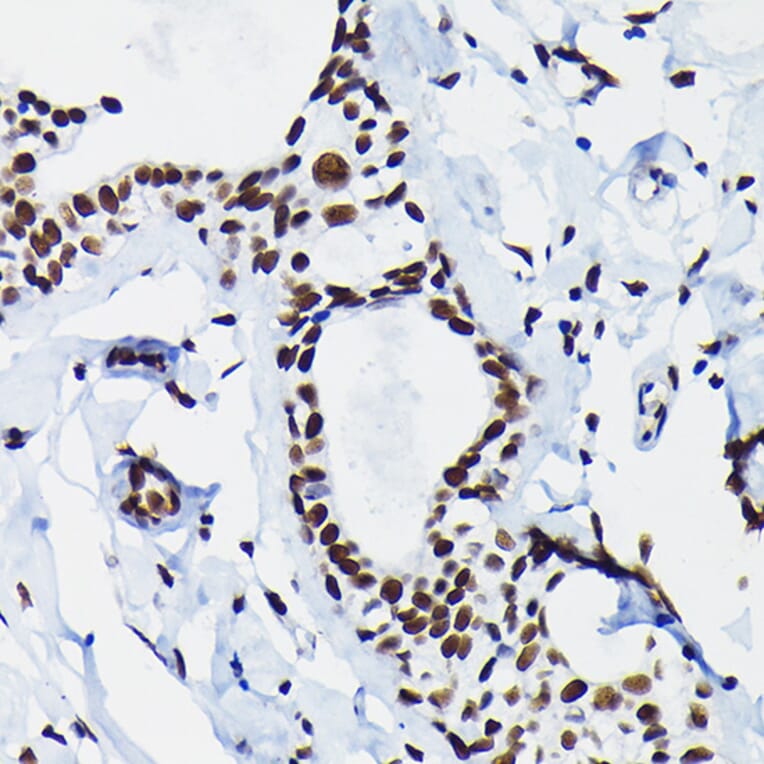 Immunohistochemistry - Anti-HDGF Antibody (A89522) - Antibodies.com