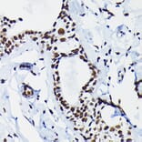 Immunohistochemistry - Anti-HDGF Antibody (A89522) - Antibodies.com