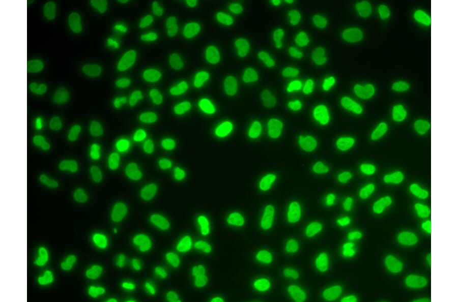Immunofluorescence - Anti-HDGF Antibody (A89522) - Antibodies.com