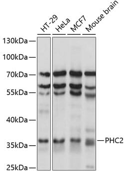 Western blot analysis of extracts of various cell lines, using Anti-PHC2 Antibody (A14727) at 1:1,000 dilution.
Secondary antibody: Goat Anti-Rabbit IgG (H+L) (HRP) (AS014) at 1:10,000 dilution.
Lysates / proteins: 25µg per lane.
Blocking buffer: 3% non-fat dry milk in TBST.
Detection: ECL Basic Kit (RM00020).
Exposure time: 5s.