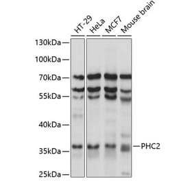 Western Blot - Anti-PHC2 Antibody (A89523) - Antibodies.com