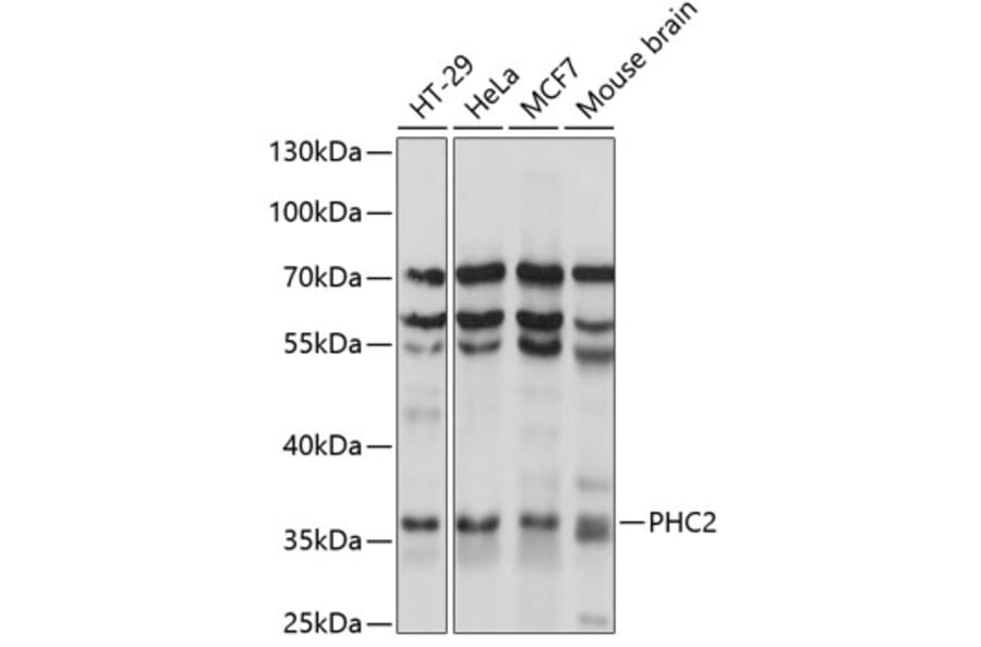 Western Blot - Anti-PHC2 Antibody (A89523) - Antibodies.com