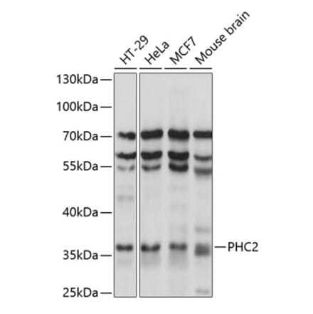 Western Blot - Anti-PHC2 Antibody (A89523) - Antibodies.com