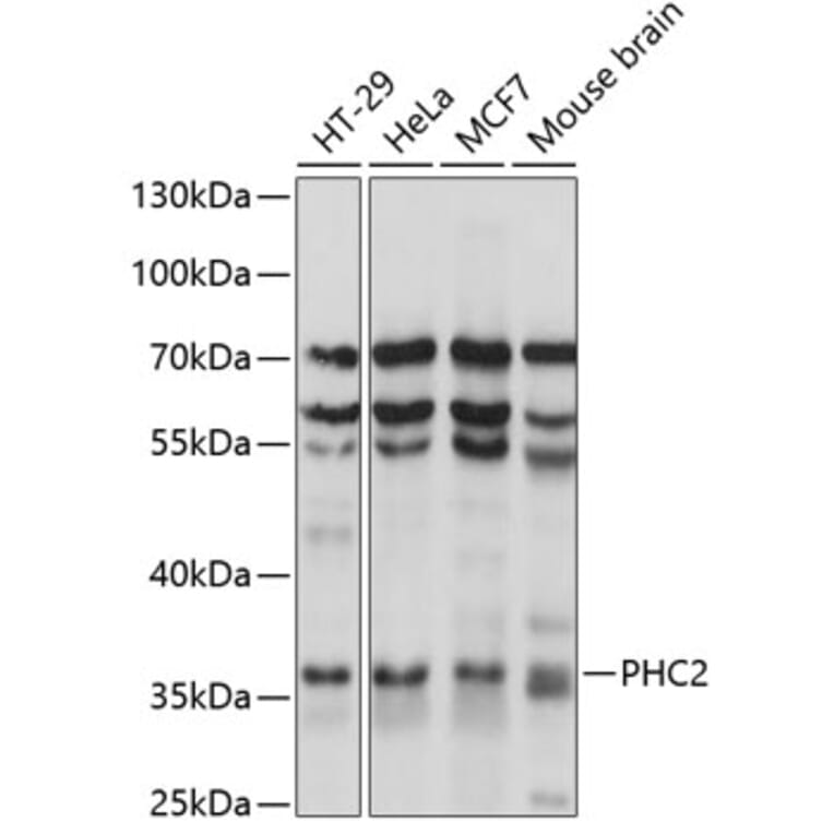 Western Blot - Anti-PHC2 Antibody (A89523) - Antibodies.com