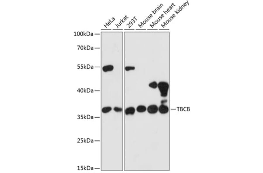 Western Blot - Anti-CKAP1/TBCB Antibody (A89524) - Antibodies.com