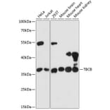 Western Blot - Anti-CKAP1/TBCB Antibody (A89524) - Antibodies.com