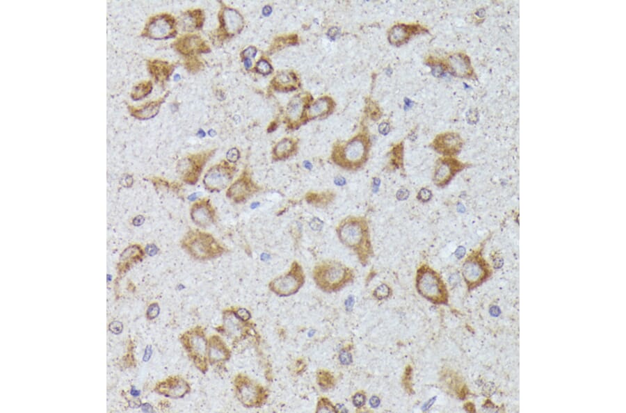 Immunohistochemistry - Anti-CKAP1/TBCB Antibody (A89524) - Antibodies.com