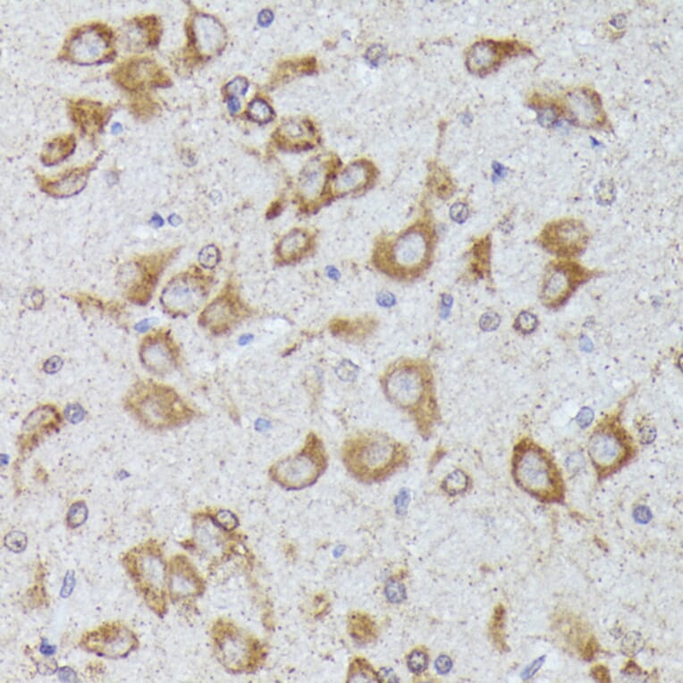 Immunohistochemistry - Anti-CKAP1/TBCB Antibody (A89524) - Antibodies.com