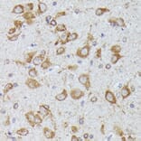 Immunohistochemistry - Anti-CKAP1/TBCB Antibody (A89524) - Antibodies.com
