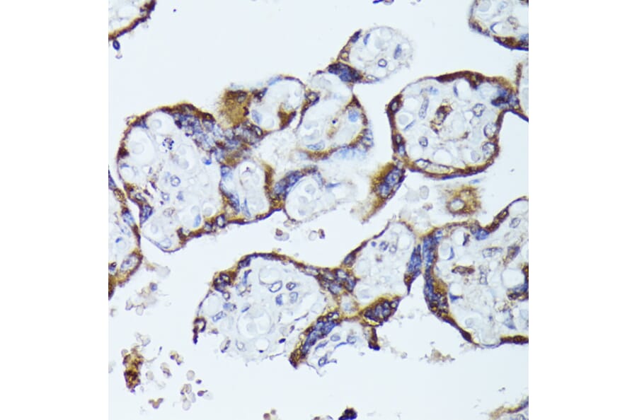 Immunohistochemistry - Anti-CKAP1/TBCB Antibody (A89524) - Antibodies.com
