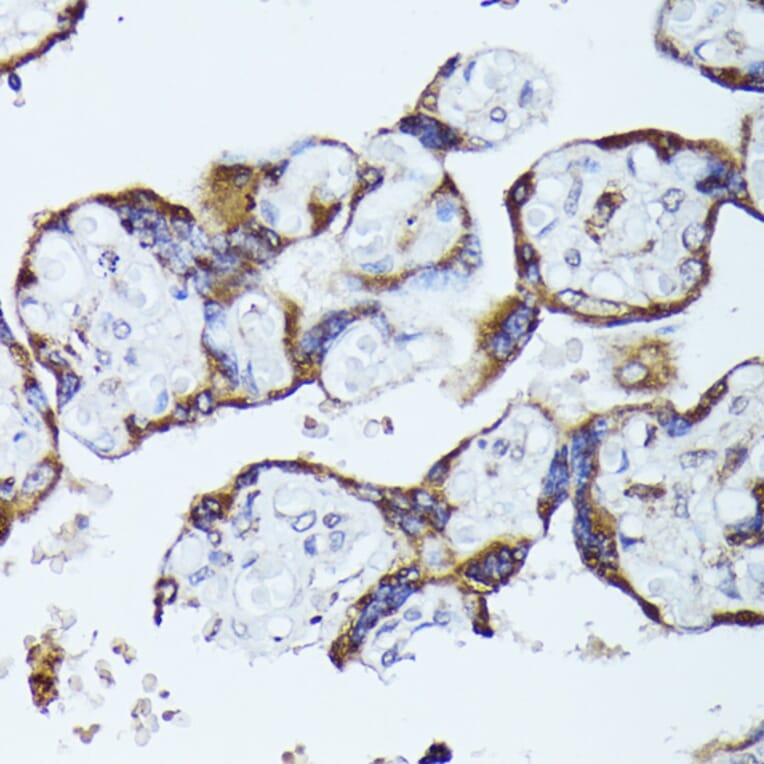 Immunohistochemistry - Anti-CKAP1/TBCB Antibody (A89524) - Antibodies.com