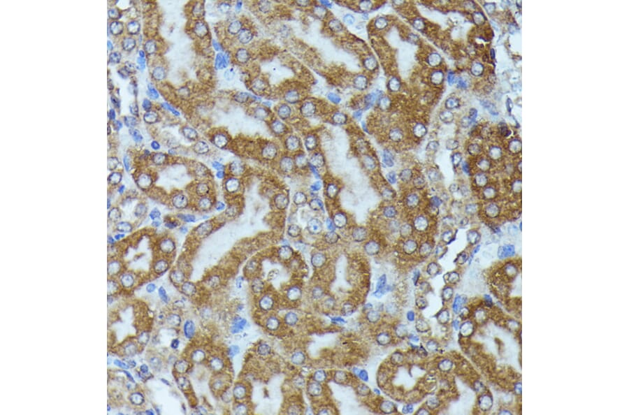 Immunohistochemistry - Anti-CKAP1/TBCB Antibody (A89524) - Antibodies.com