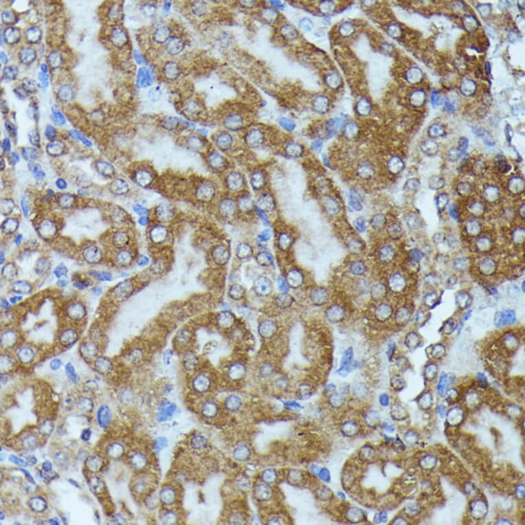 Immunohistochemistry - Anti-CKAP1/TBCB Antibody (A89524) - Antibodies.com