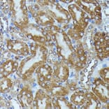 Immunohistochemistry - Anti-CKAP1/TBCB Antibody (A89524) - Antibodies.com
