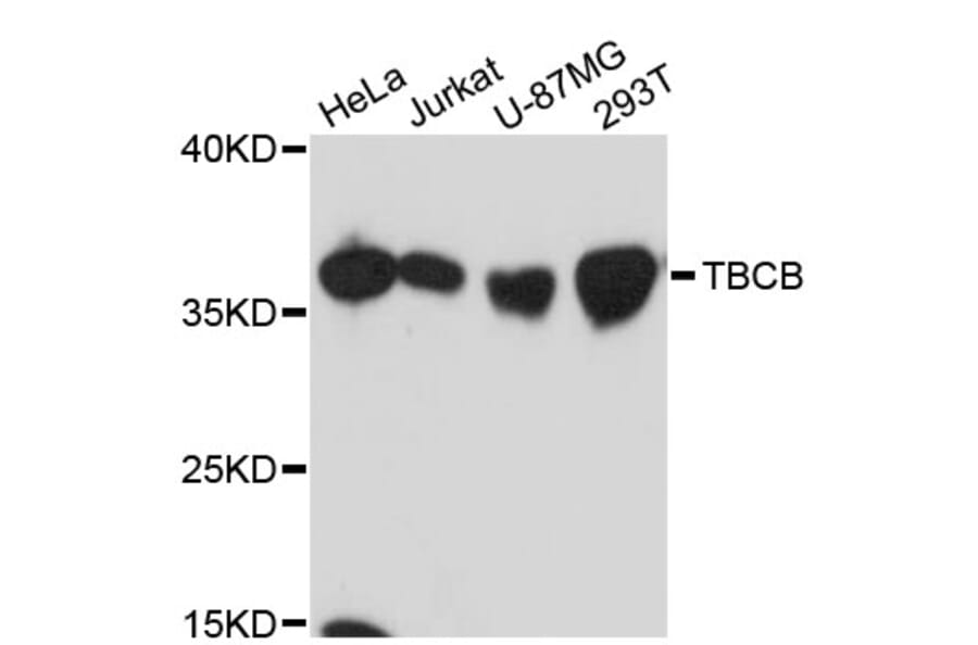 Western Blot - Anti-TBCB Antibody (A13012) - Antibodies.com