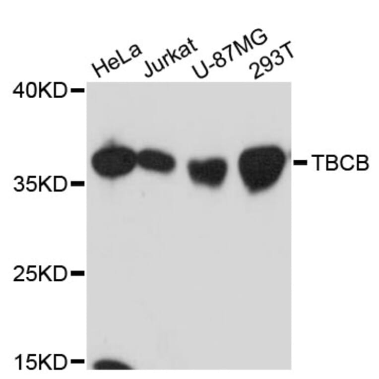 Western Blot - Anti-TBCB Antibody (A13012) - Antibodies.com