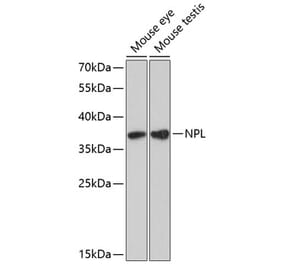 Western Blot - Anti-NPL Antibody (A89526) - Antibodies.com