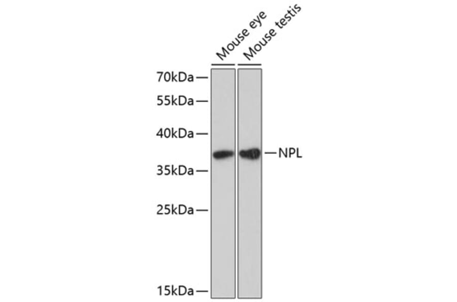Western Blot - Anti-NPL Antibody (A89526) - Antibodies.com