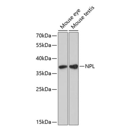 Western Blot - Anti-NPL Antibody (A89526) - Antibodies.com