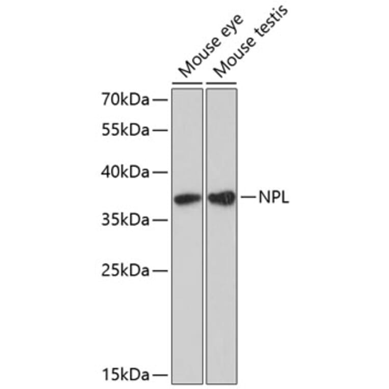Western Blot - Anti-NPL Antibody (A89526) - Antibodies.com