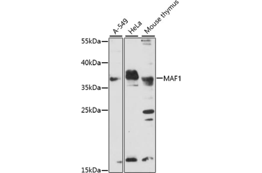 Western Blot - Anti-MAF1 Antibody (A89527) - Antibodies.com