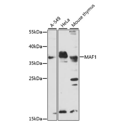 Western Blot - Anti-MAF1 Antibody (A89527) - Antibodies.com