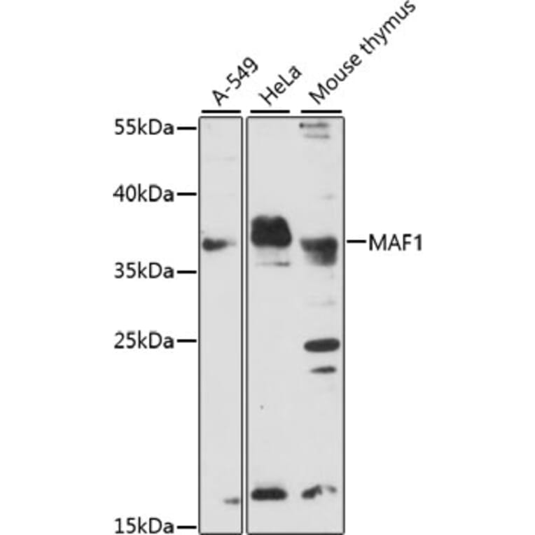 Western Blot - Anti-MAF1 Antibody (A89527) - Antibodies.com