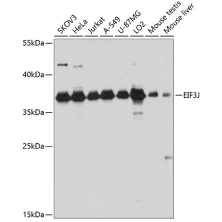 Western Blot - Anti-EIF3S1/EIF3J Antibody (A89528) - Antibodies.com