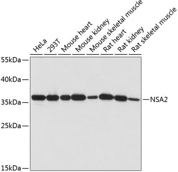 Western blot analysis of extracts of various cell lines, using Anti-NSA2 Antibody (A14475) at 1:1,000 dilution.
Secondary antibody: Goat Anti-Rabbit IgG (H+L) (HRP) (AS014) at 1:10,000 dilution.
Lysates / proteins: 25µg per lane.
Blocking buffer: 3% non-fat dry milk in TBST.
Detection: ECL Basic Kit (RM00020).
Exposure time: 60s.