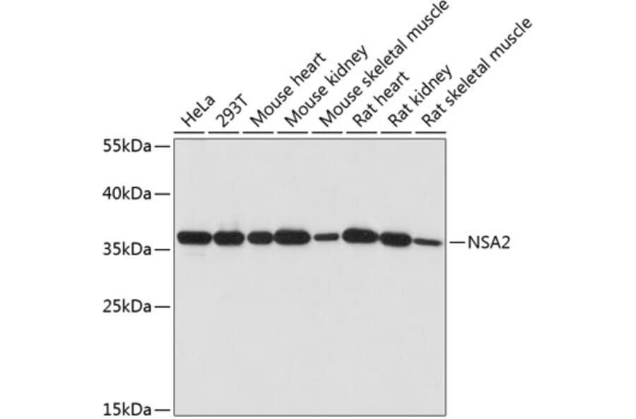 Western Blot - Anti-NSA2 Antibody (A89529) - Antibodies.com