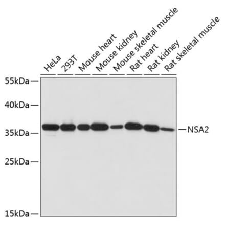 Western Blot - Anti-NSA2 Antibody (A89529) - Antibodies.com