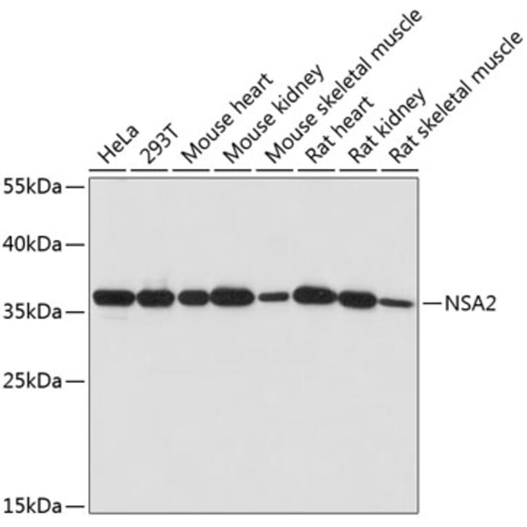 Western Blot - Anti-NSA2 Antibody (A89529) - Antibodies.com