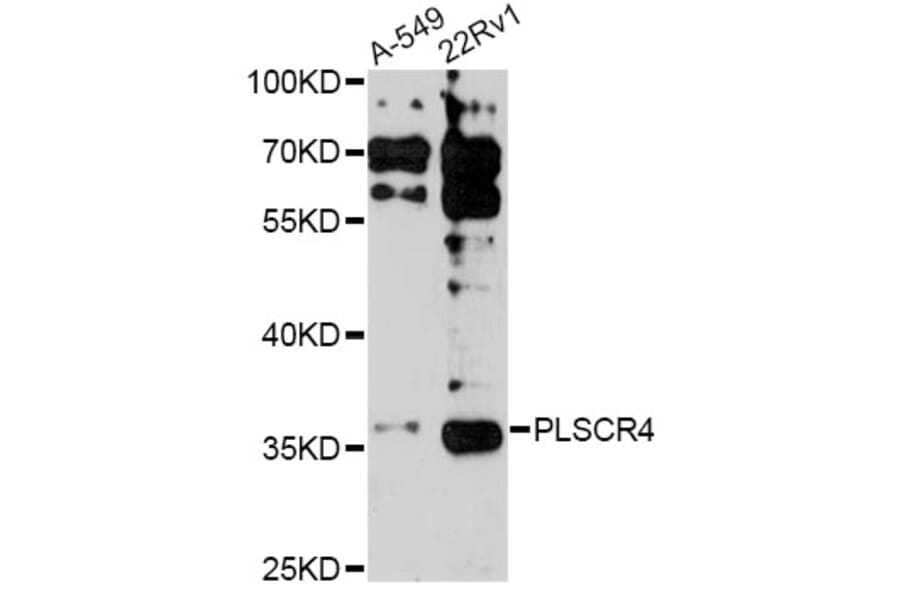 Western Blot - Anti-PLSCR4 Antibody (A14670) - Antibodies.com