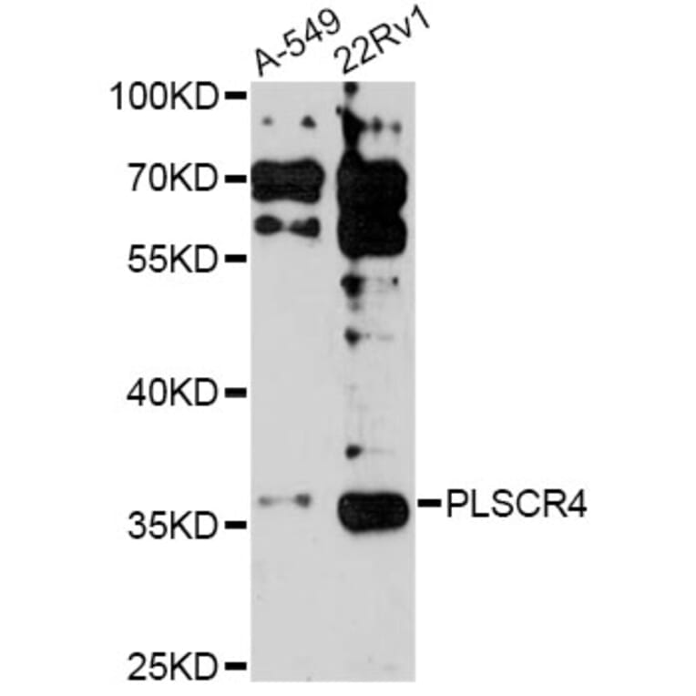 Western Blot - Anti-PLSCR4 Antibody (A14670) - Antibodies.com