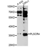 Western Blot - Anti-PLSCR4 Antibody (A14670) - Antibodies.com