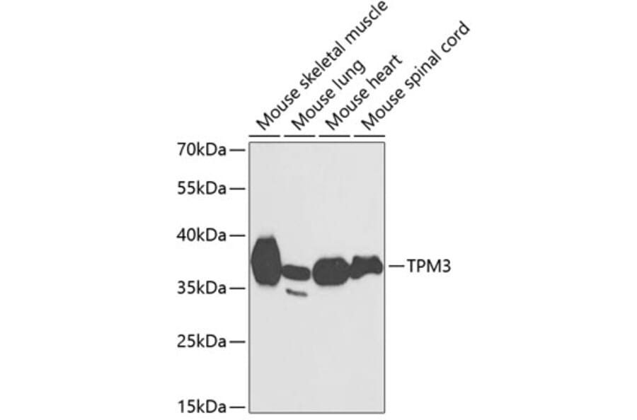 Western Blot - Anti-Tropomyosin 3 Antibody (A89531) - Antibodies.com