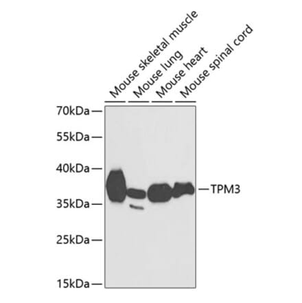 Western Blot - Anti-Tropomyosin 3 Antibody (A89531) - Antibodies.com