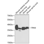Western Blot - Anti-Tropomyosin 3 Antibody (A89531) - Antibodies.com