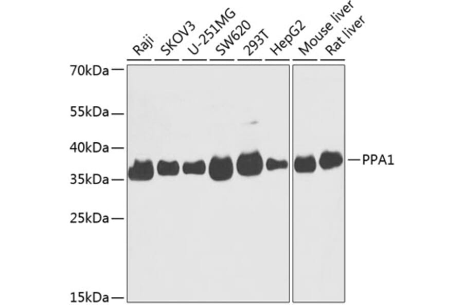 Western Blot - Anti-PPA1 Antibody (A89532) - Antibodies.com