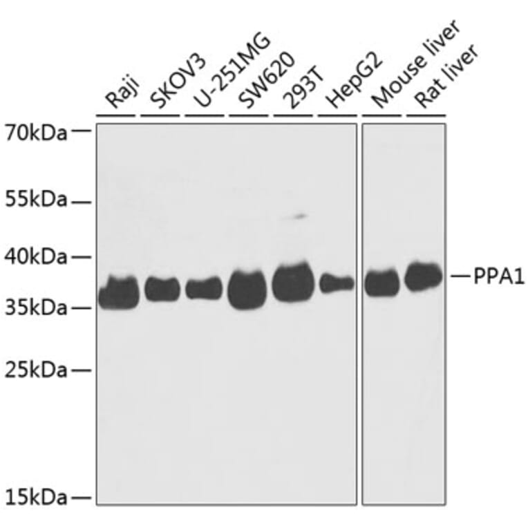 Western Blot - Anti-PPA1 Antibody (A89532) - Antibodies.com