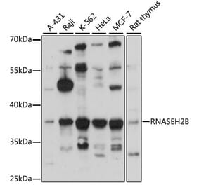 Western Blot - Anti-RNASEH2B Antibody (A89533) - Antibodies.com