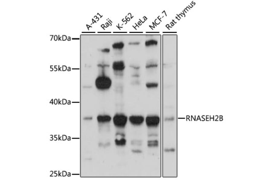 Western Blot - Anti-RNASEH2B Antibody (A89533) - Antibodies.com