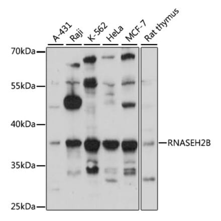 Western Blot - Anti-RNASEH2B Antibody (A89533) - Antibodies.com