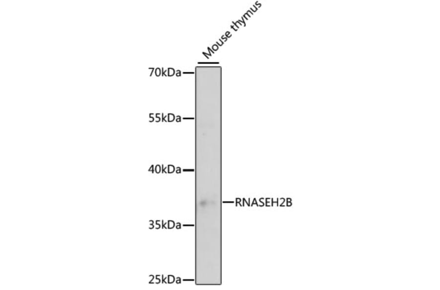 Western Blot - Anti-RNASEH2B Antibody (A89533) - Antibodies.com