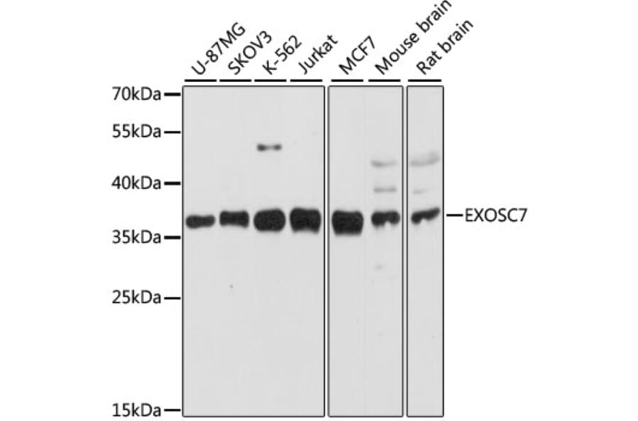 Western Blot - Anti-RRP42 Antibody (A89534) - Antibodies.com