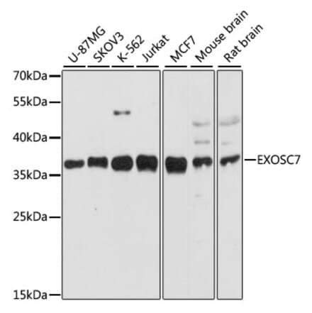 Western Blot - Anti-RRP42 Antibody (A89534) - Antibodies.com
