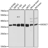 Western Blot - Anti-RRP42 Antibody (A89534) - Antibodies.com
