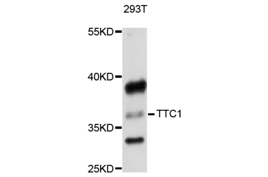 Western Blot - Anti-TTC1 Antibody (A8745) - Antibodies.com