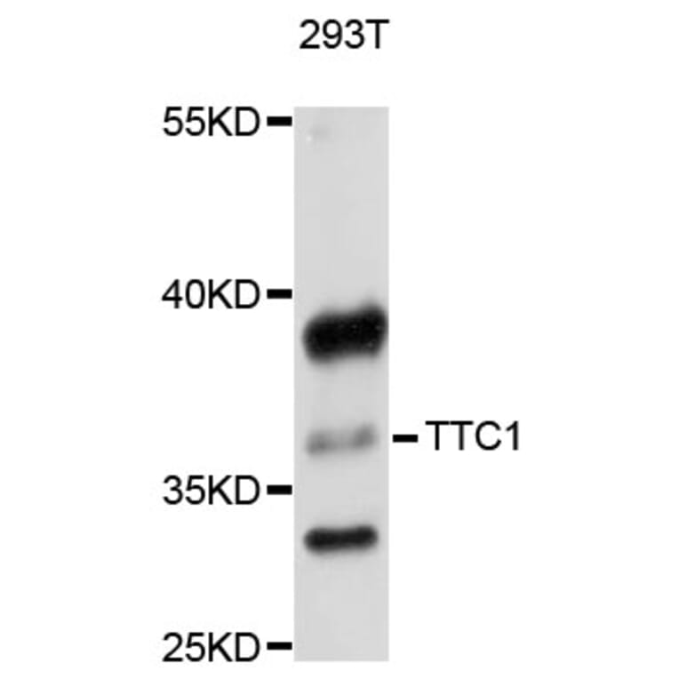 Western Blot - Anti-TTC1 Antibody (A8745) - Antibodies.com