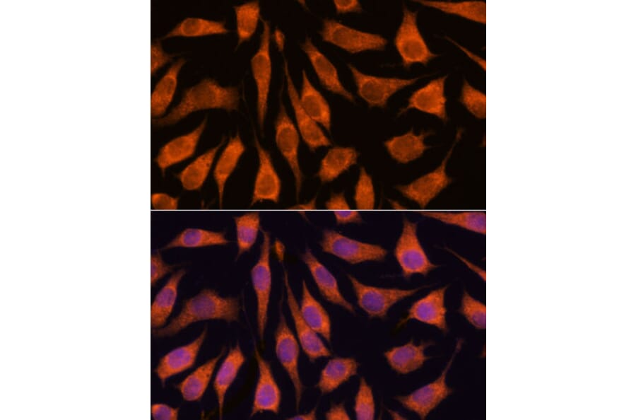 Immunofluorescence - Anti-GOLPH3/MIDAS Antibody (A89536) - Antibodies.com